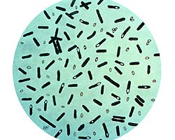 Clostridium botulinum Clostridium botulinum