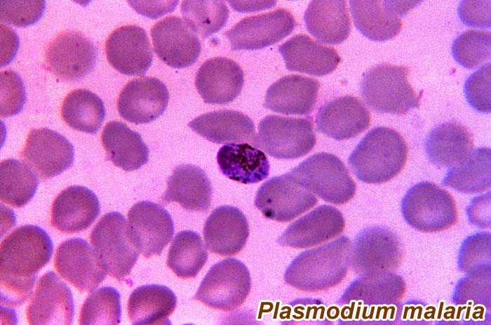 Plasmodium malaria Plasmodium malaria