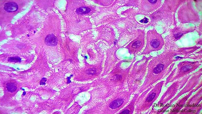 Keratinocytes Keratinocytes