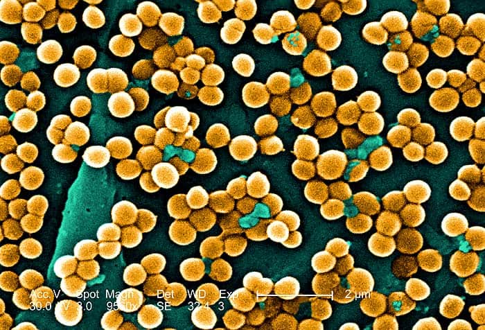 Staphylococcus aureus bacteria (Coccus) Staphylococcus aureus bacteria (Coccus)