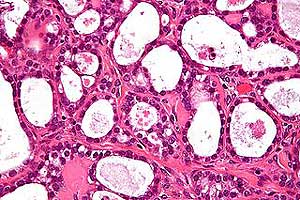 Ovary cells Ovary cells