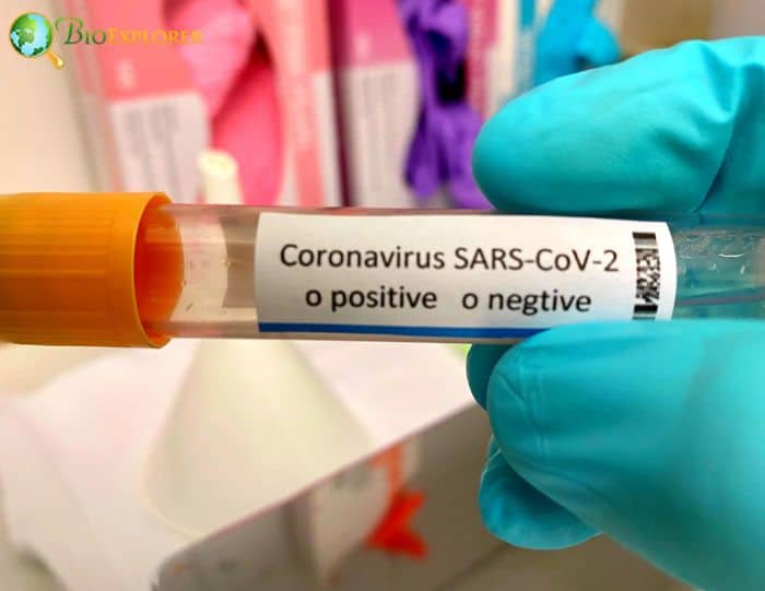 SARS Cov SARS Cov