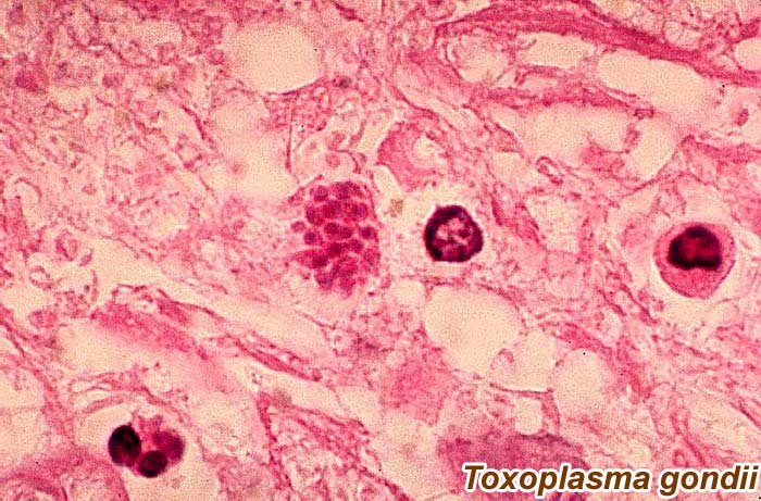 Toxoplasma gondii Toxoplasma gondii