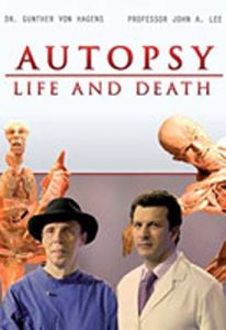 Autopsy Life and Death: Tumors
