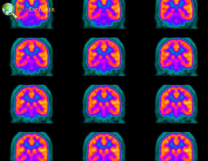 Positron Emission Tomography (PET)