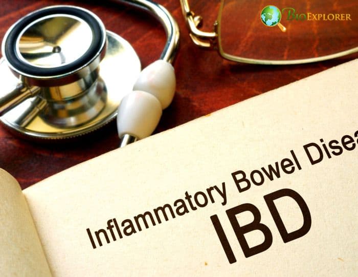 Inflammatory Bowel Disease Inflammatory Bowel Disease
