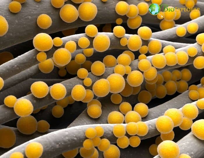 MRSA MRSA