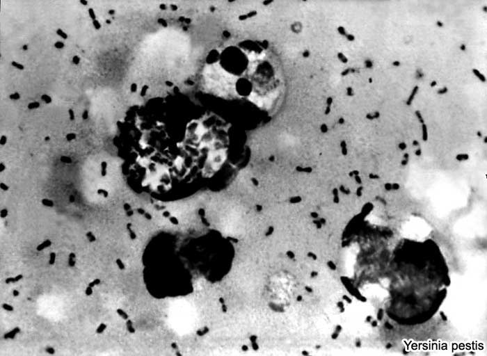 Yersinia pestis causes Bubonic Plague Yersinia pestis causes Bubonic Plague