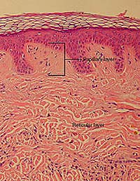 Dermis Layers Dermis Layers