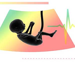 Placenta Placenta
