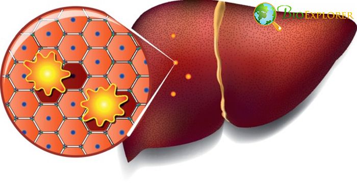 Liver Cell Toxins Liver Cell Toxins