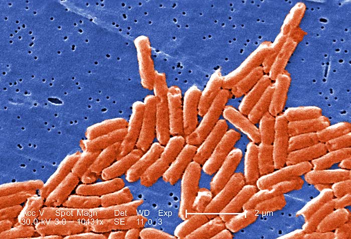 Salmonella sp bacteria (Rod-Shaped) Salmonella sp bacteria (Rod-Shaped)