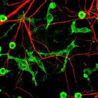 Neuronal cells Neuronal cells