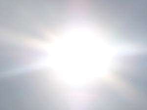 Sun Damaging Effect Sun Damaging Effect
