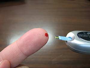 Blood Glucose Blood Glucose