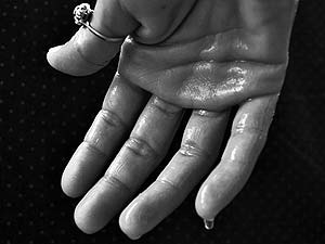Sweat Glands Sweat Glands