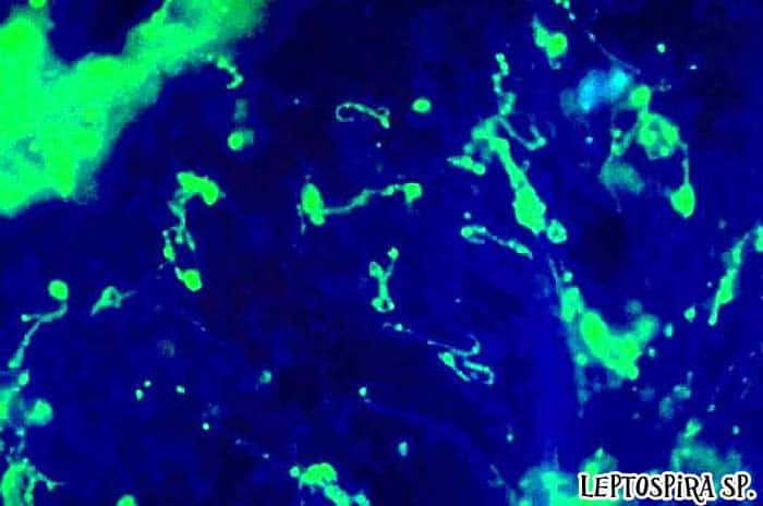 Leptospira sp. causes Leptospirosis Leptospira sp. causes Leptospirosis