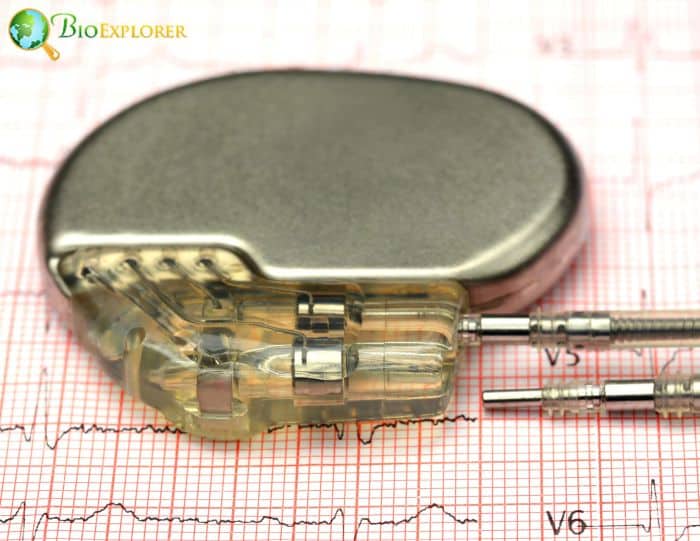 Pacemaker Pacemaker