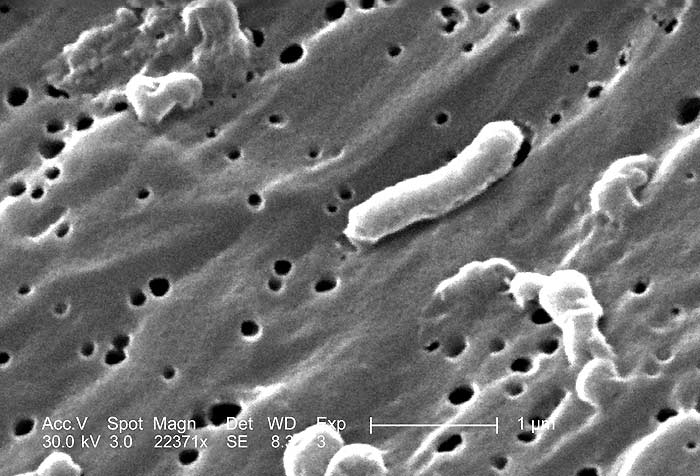 Vibrio cholerae bacteria (Sprial Shaped)