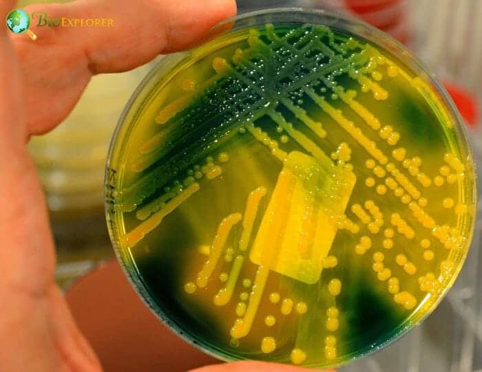 4 Bacterial Biofilms 4 Bacterial Biofilms
