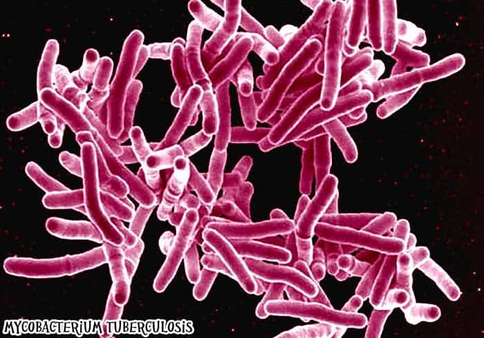 Mycobacterium tuberculosis causes TB. Mycobacterium tuberculosis causes TB.