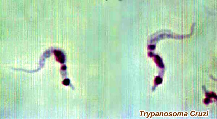 Trypanosoma Cruzi Trypanosoma Cruzi