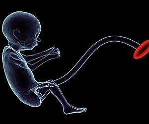 Fetus Fetus