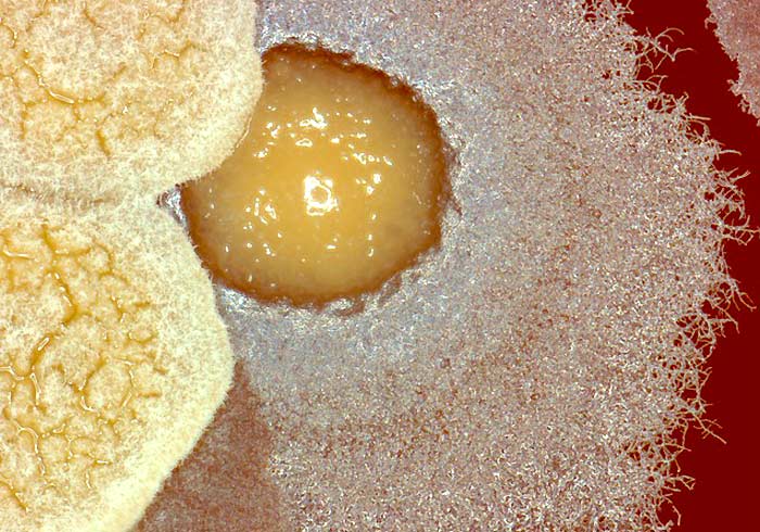 Filamentous bacteria nocardia farcinica Filamentous bacteria Nocardia farcinica