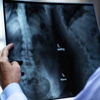 spinal cord spinal cord