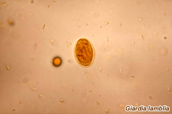 Giardia lamblia Giardia lamblia