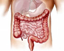 Intestines Fungal Growth Intestines Fungal Growth