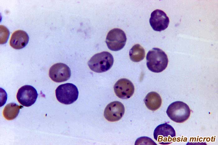 Babesia microti Babesia microti