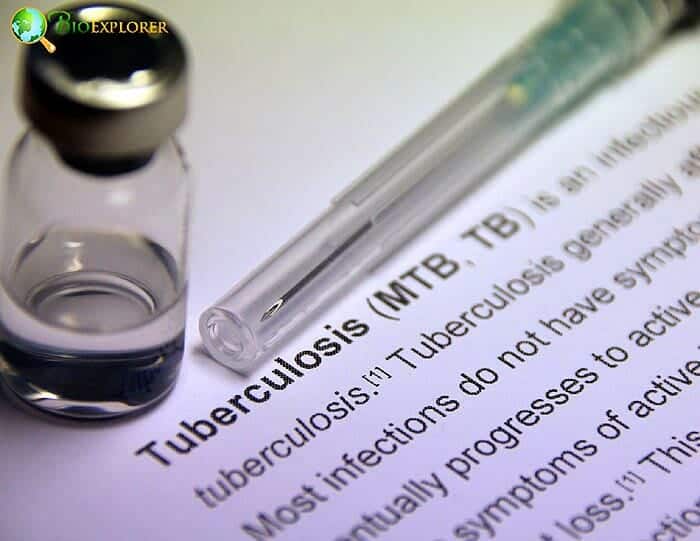 Tuberculosis Bacterium Tuberculosis Bacterium
