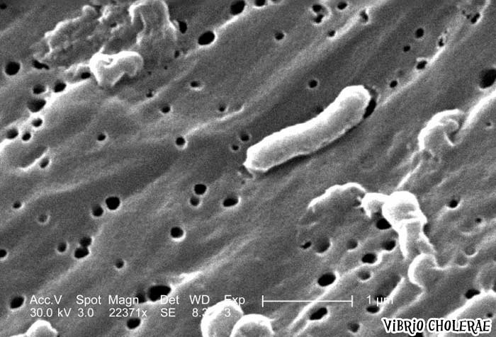 Vibrio cholerae causes Cholera Vibrio cholerae causes Cholera