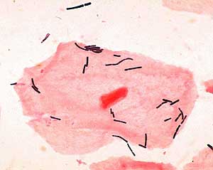 Lactobacillus bacteria Lactobacillus bacteria