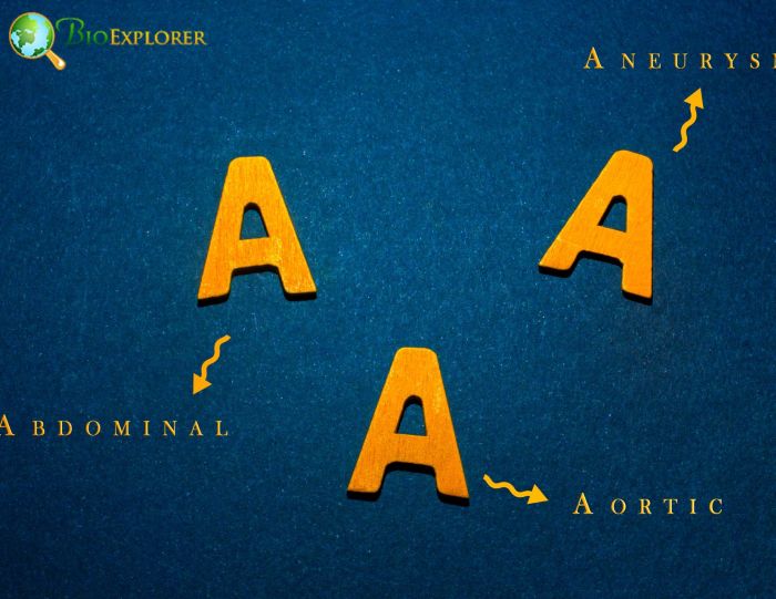 Aortic Aneurysms Aortic Aneurysms