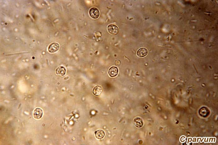 Cryptosporidium parvum Cryptosporidium parvum