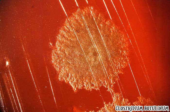Clostridium botulinum causes Botulism Clostridium botulinum causes Botulism