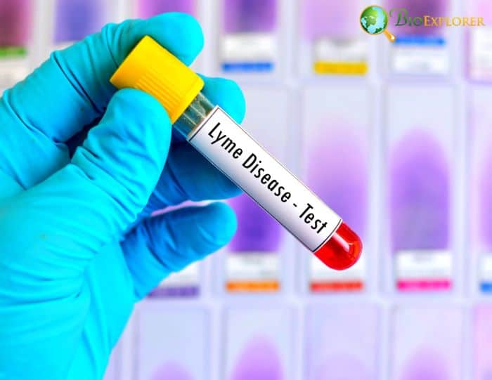 Lyme Disease Lyme Disease