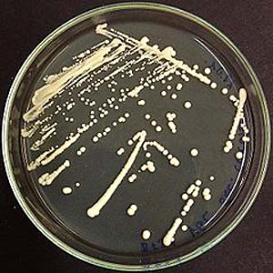 Saccharomyces cerevisiae