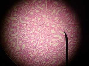 Seminiferous tubule Seminiferous tubule