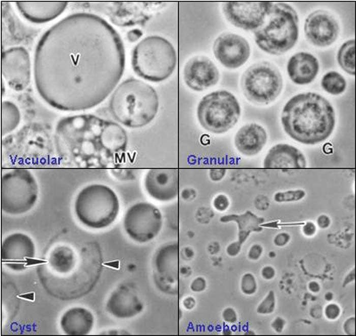 Blastocystis hominis Blastocystis hominis
