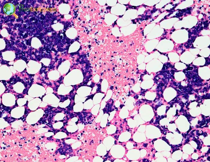 Bone Marrow Cells Bone Marrow Cells