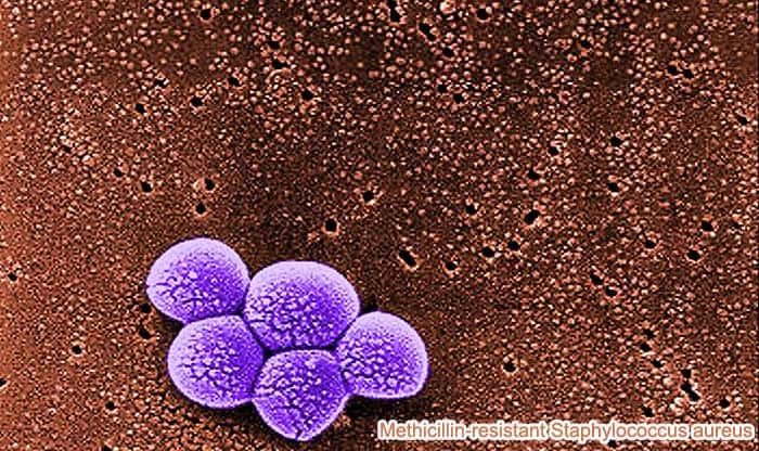 MRSA MRSA