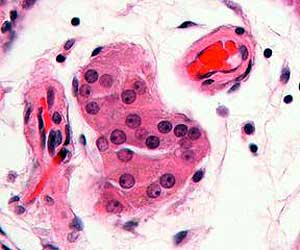 Leydig cells Leydig cells