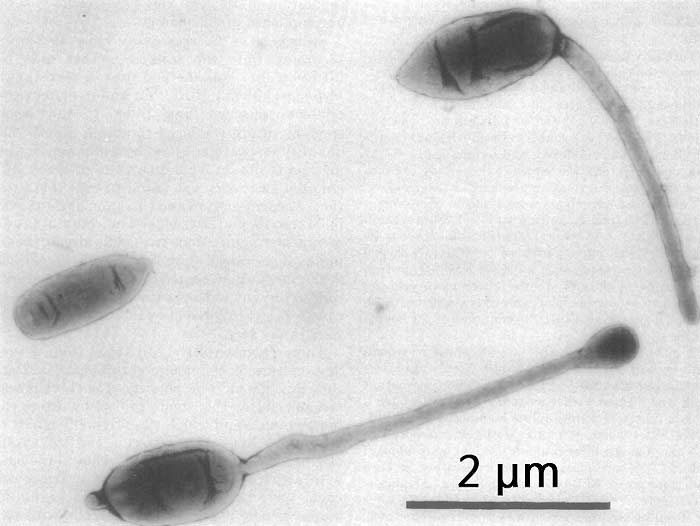 Hypomicrobium bacteria (Appendaged)