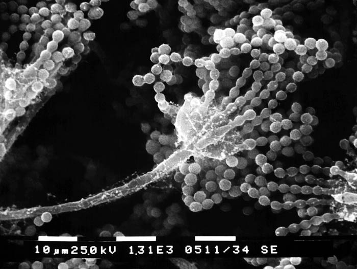 Close-up of Asexual Aspergillus Fungi Close-up of Asexual Aspergillus Fungi