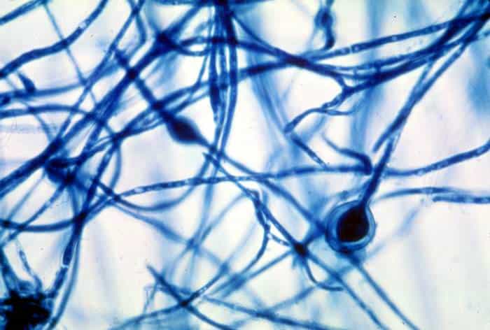 Chlamydospores of the Fungus Chlamydospores of the Fungus