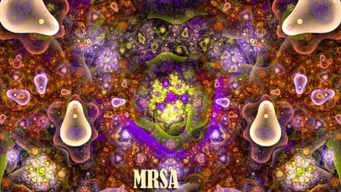 Is MRSA Contagious? Is MRSA Contagious?