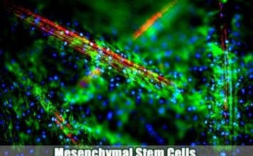 Mesenchymal Stem Cells